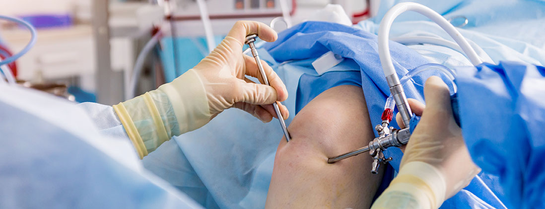 knee-arthroscopy-bhopal