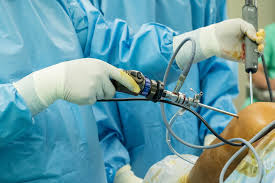 arthroscopy